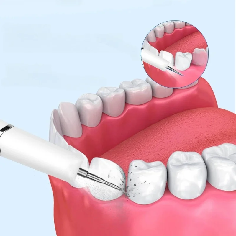 Ultrasonic Dental Scaling Tooth Calculus Remover Dental Scaler for Teeth Cleaner Electric Sonic Stains Tartar Plaque Remover