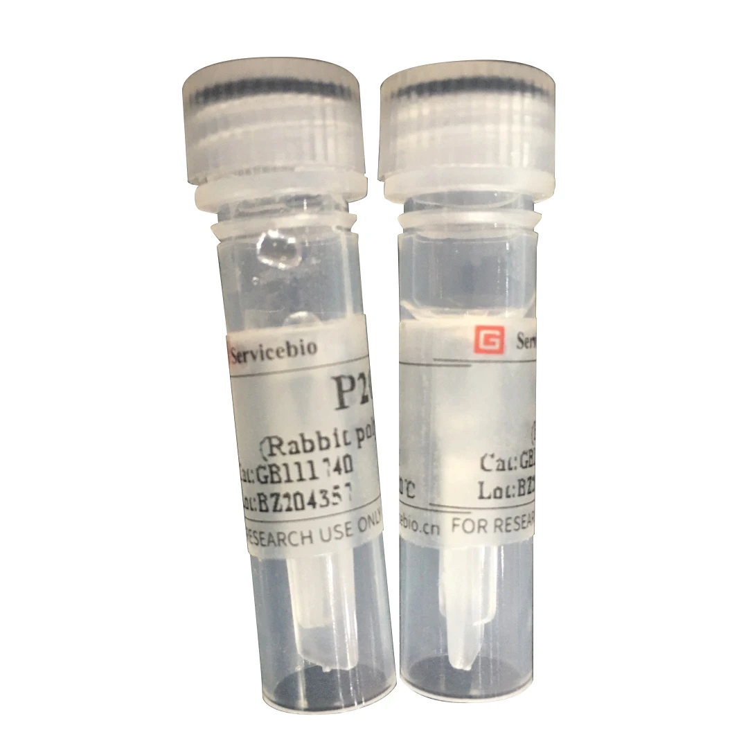 Primary Antibodies Polyclonal Antibody Anti-p53 Rabbit biotechnology laboratory