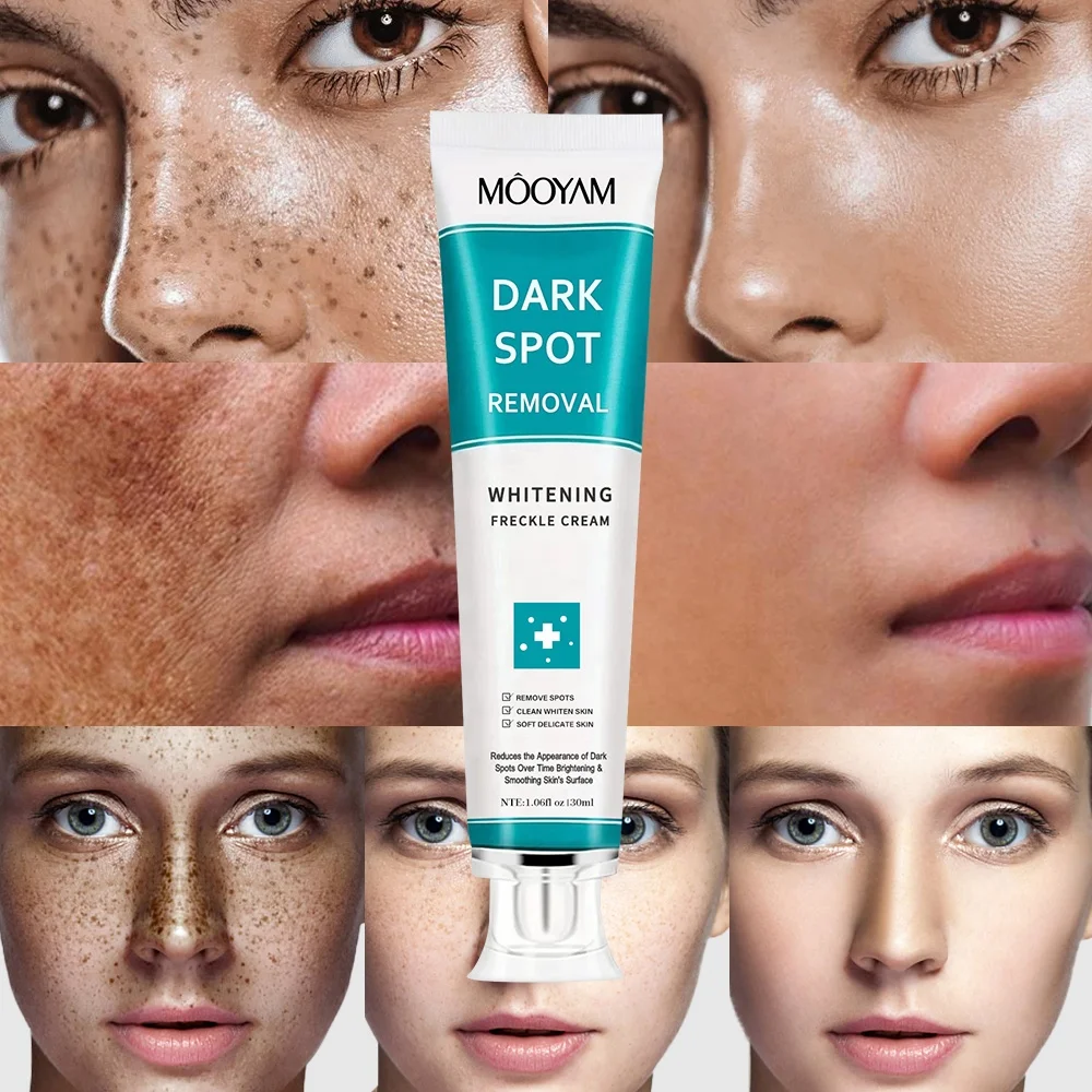 Strong Effective Whitening Freckle Cream Face Remove Melasma Dark Spots Melanin Remover Private Label Brighten Skin Care Cream