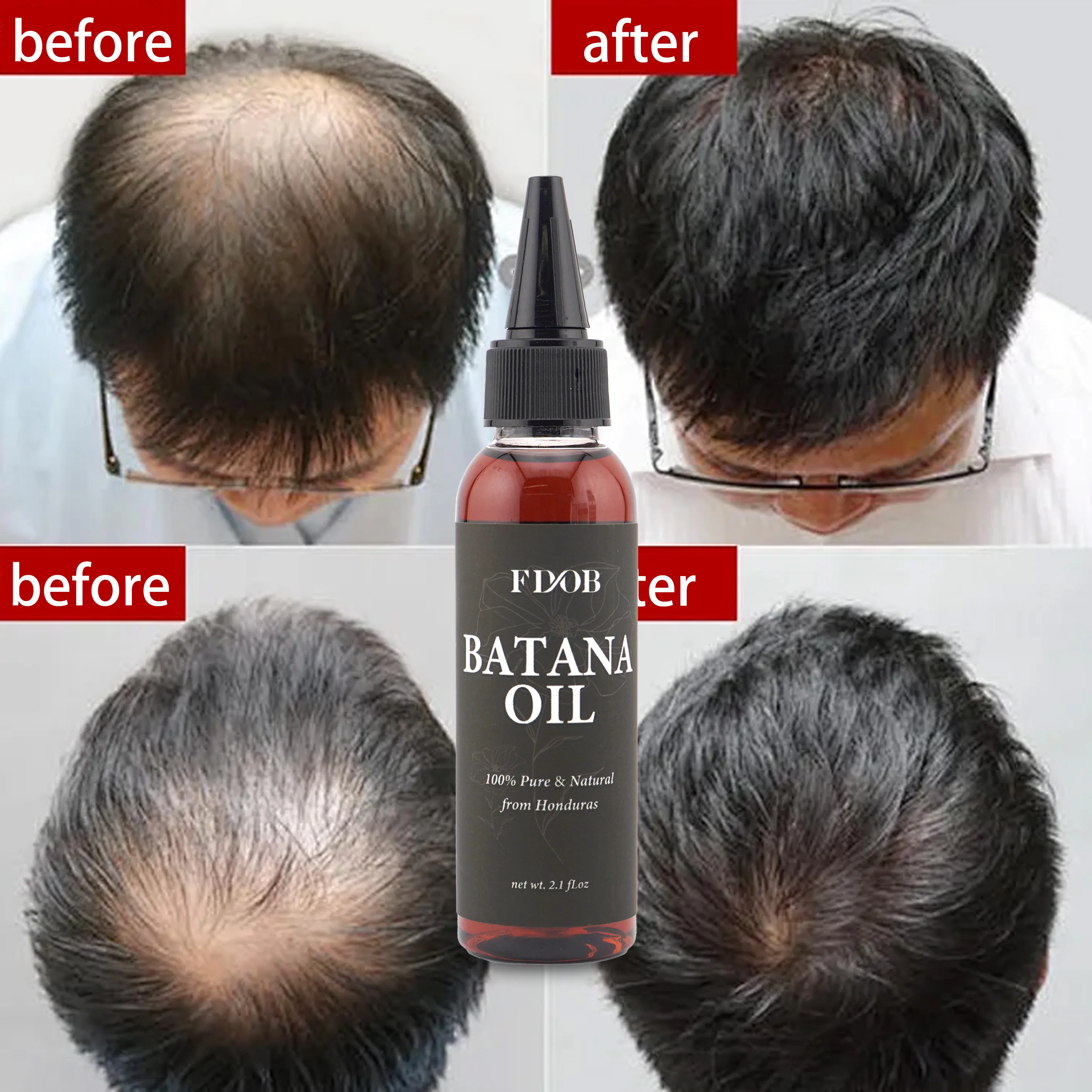 Best Seller Hair Growth Promotes Hair Wellness for Men  Women Enhances Hair and Skin Radiance 60ml Batana Oil