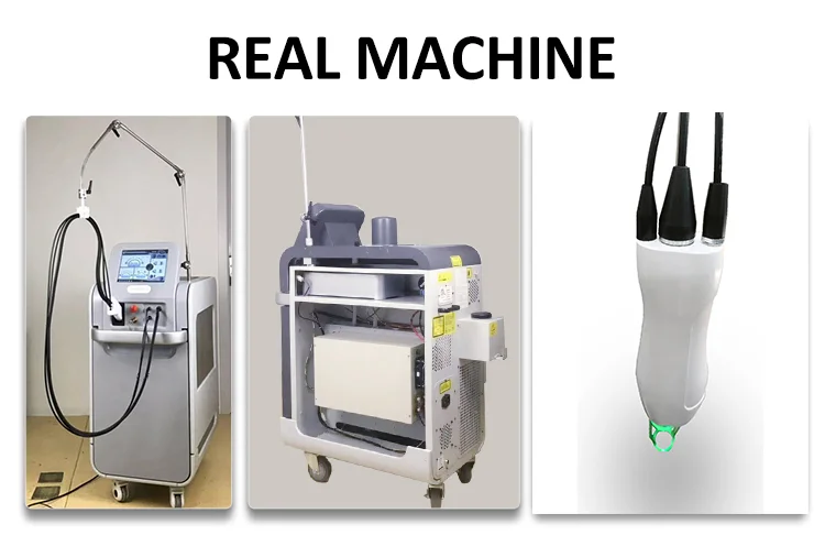 OEM logo Sincoheren Italy Pump Germany Bars 808 Alexandrite Laser 755 nm For Permanent Hair Removal  for Aesthetic Used Laser