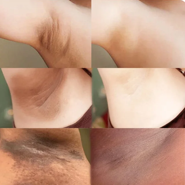 Various new retinol AHA vitamin c moisturizer lightening women skin whitening body lotion armpit underarm whitening cream