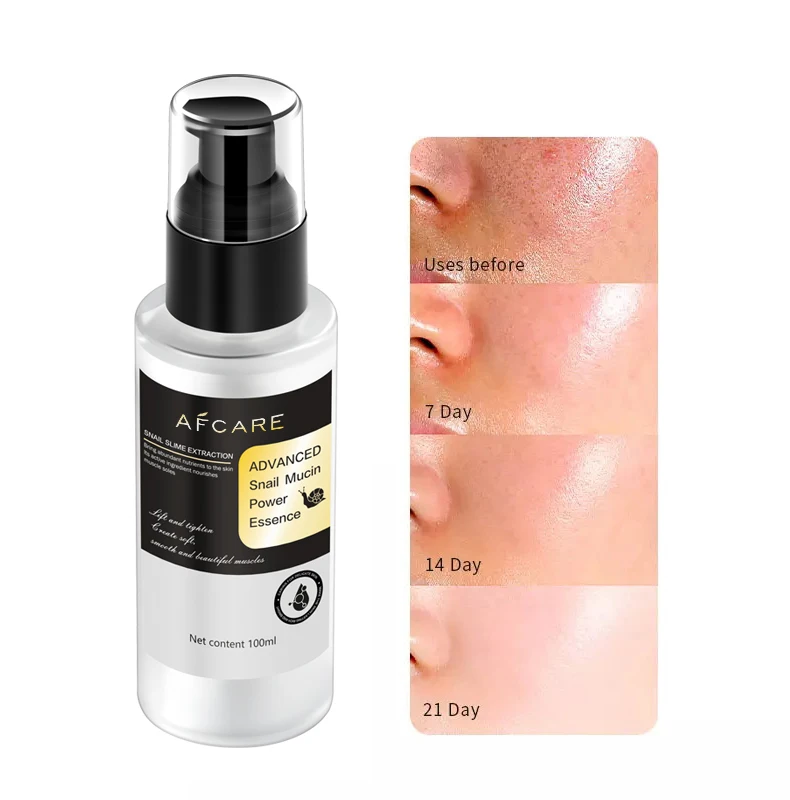 6 in Face Serum Sulfate-free Moisturizer & Anti-aging and Collagen & Vitamin E Hydrating Serum for Face With Snail Secretion