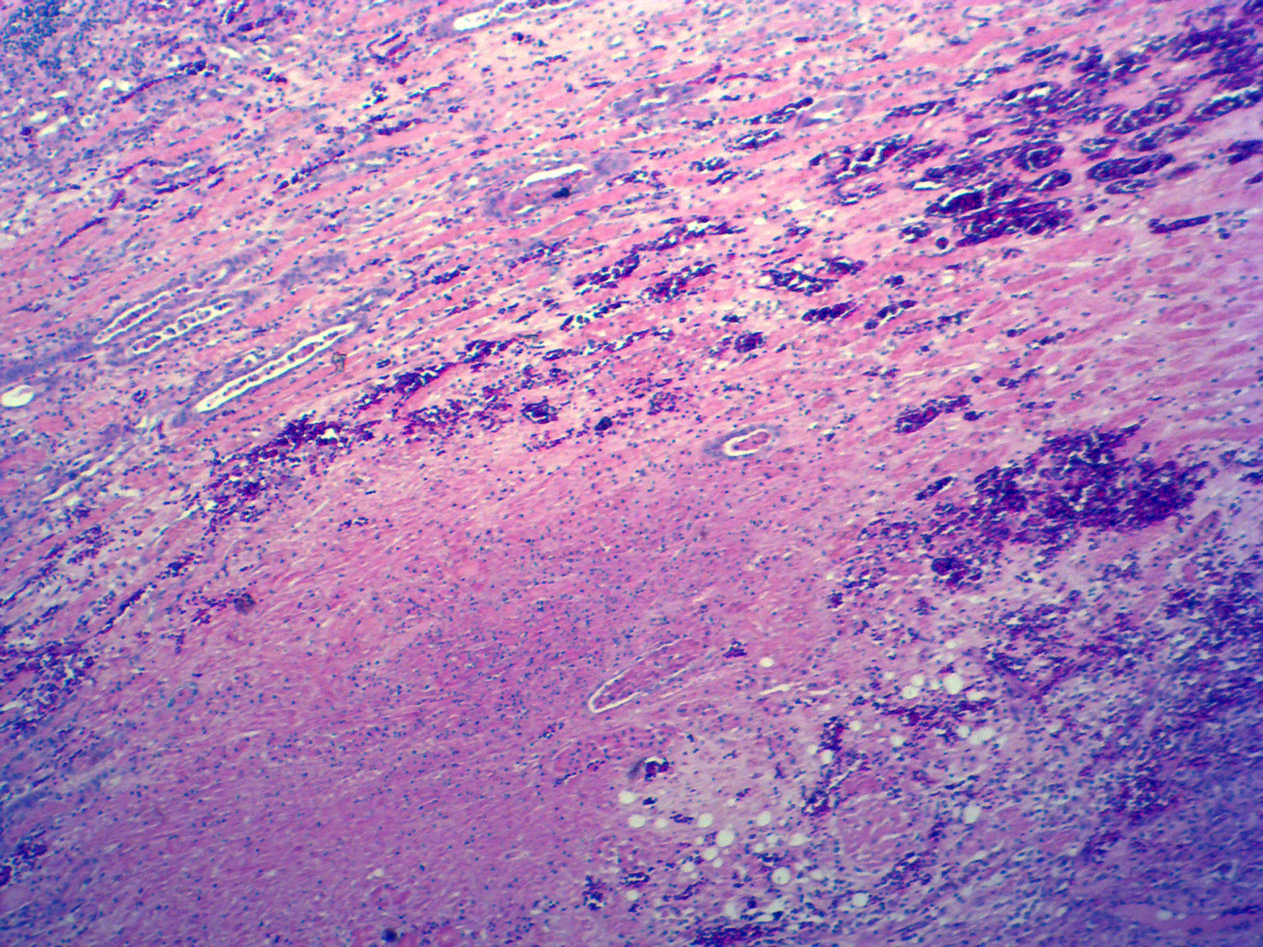 Medical biology laboratory human pathology preparation microscope slide specimen equipment