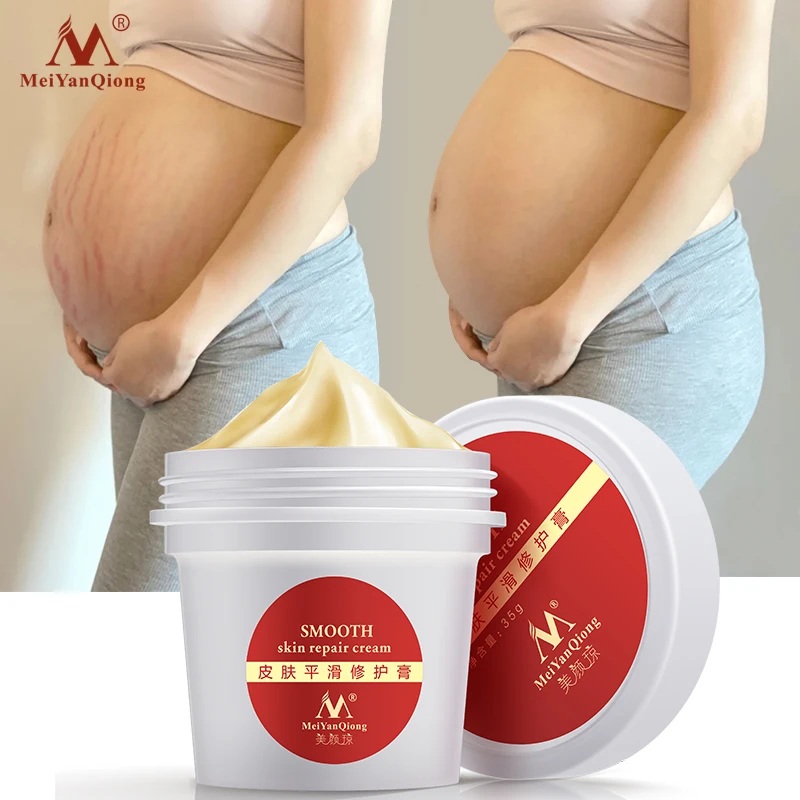 Body Skin Care stretch marks scar removal cream Maternity treatment Anti Vergeture Repair Stretch Mark Cream