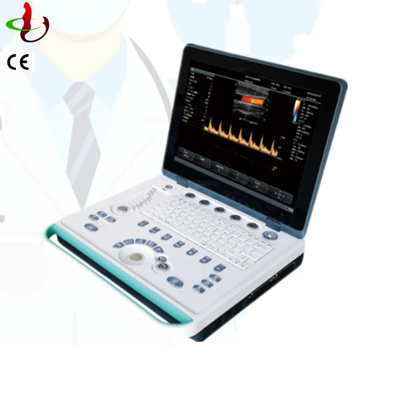 Дешевый ноутбук Ecograph Лучшие производители ультразвука цветная диагностика ультразвук