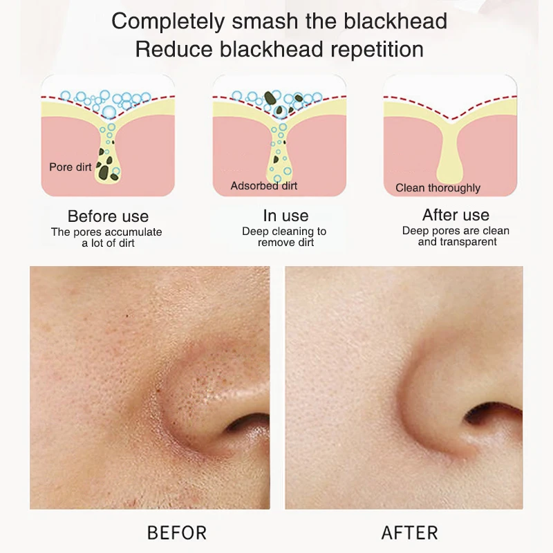 Natural Organic Green Tea Clay Mask Purifying Deep Cleansing Moisturizing Hydrating Blackhead Remover Acne Pores