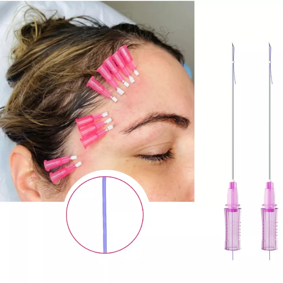 Korea Medical Skin Tightening Lips Wrinkle Filling Threads Pdo Thread Mono 29G 25mm