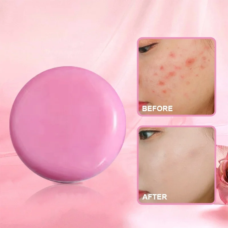 Customized OEM Facial Cleanser Pink Lovely Whitening Bleaching Organic 100% Pure Olive Glycerin Rose Essential Oil Handmade Soap