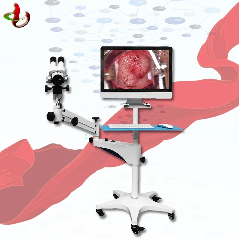 Trolley Gynecology Vagina Examination Endoscope Full HD Digital Video optical Colposcope