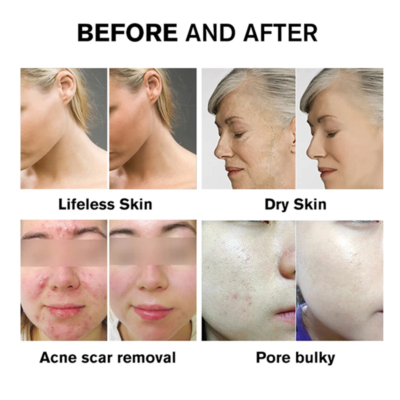 Portable 7 IN 1 Light Color Body Led Red Light Therapy 240pcs Lamp Skin Rejuvenation Facial Beauty