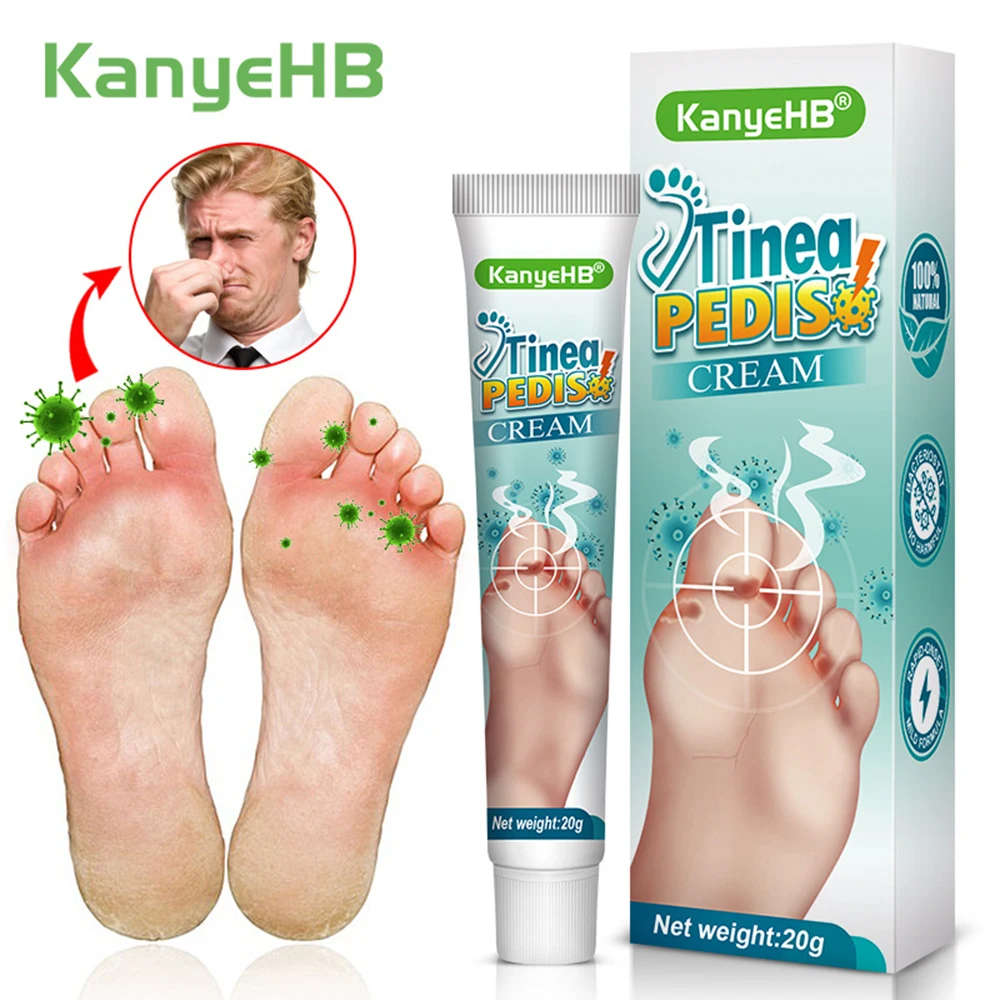 KanyeHB Beriberi Ointment Foot Odor Care Cream for foot skin health care for dermatophytosis disease and dietetic neuritis