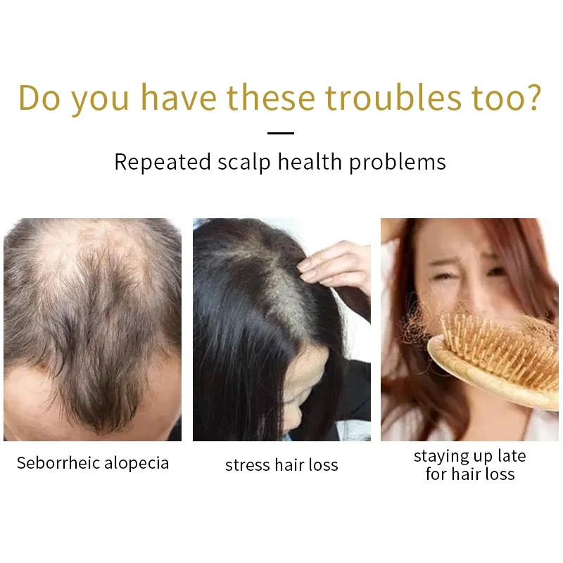 1 liter Hair Care Treatment  hair growth Oil agent Prevents Hair Loss Nourishing Growth Serum