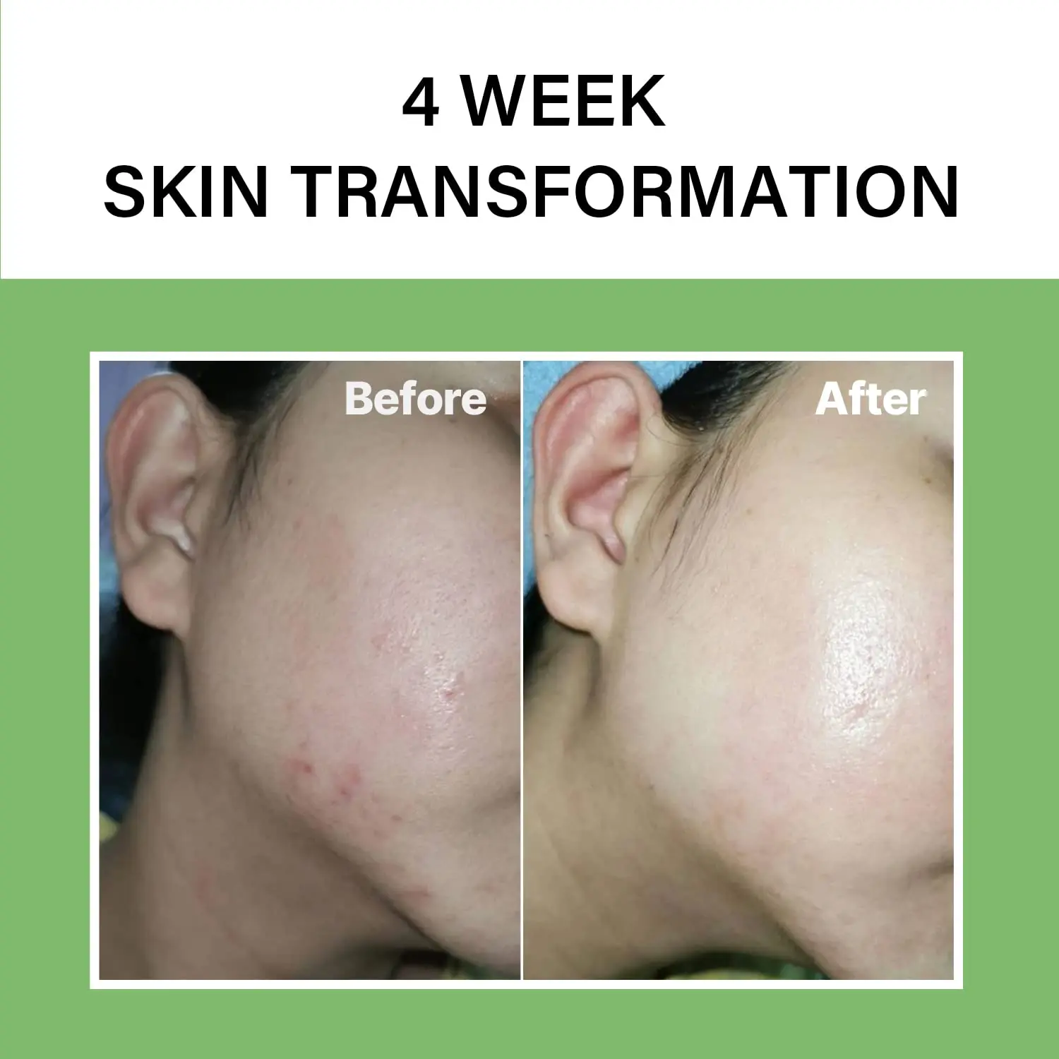 Korean Skin Care Products Noni Serum Niacinamide Hydrating Facial Serum For Fine Lines Wrinkles