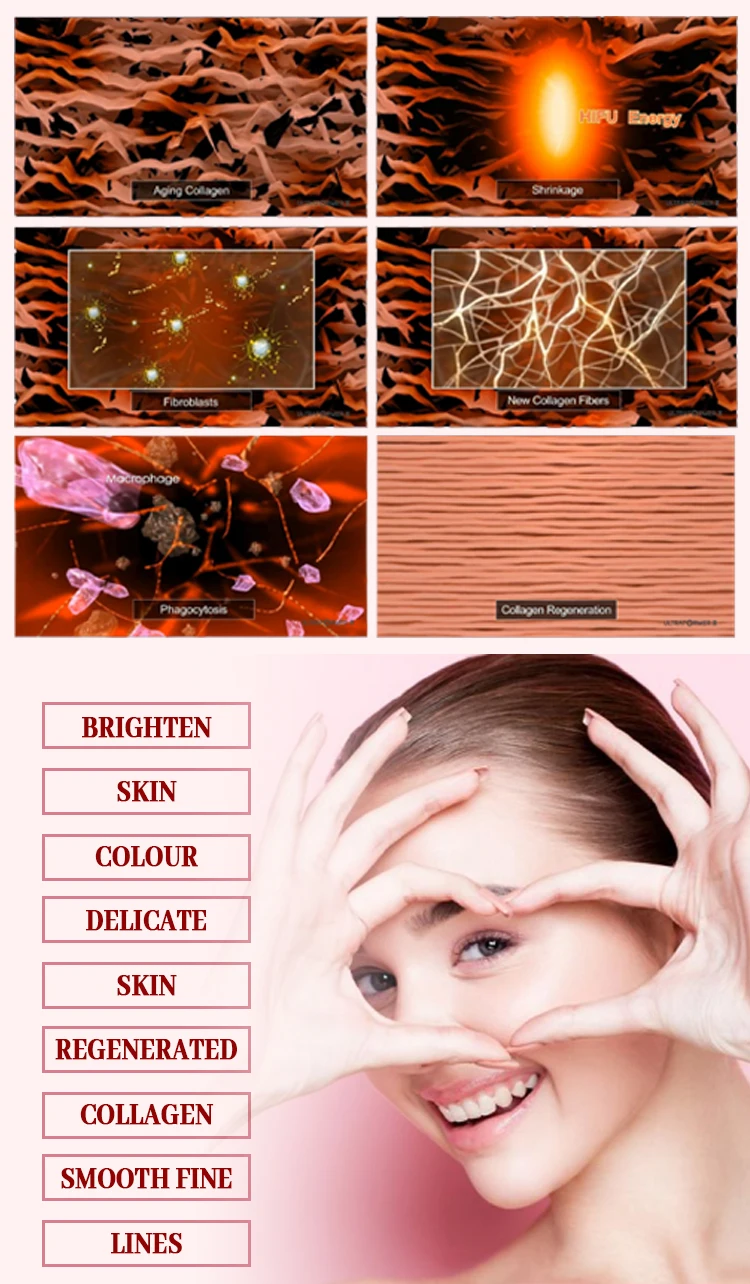 Newest 4 In 1 3d Hifu Vmax Hifu Vaginal Tightening 3d Hifus Rf Needling Fractional 4 In 1 Skin Tightening Anti-aging Machine