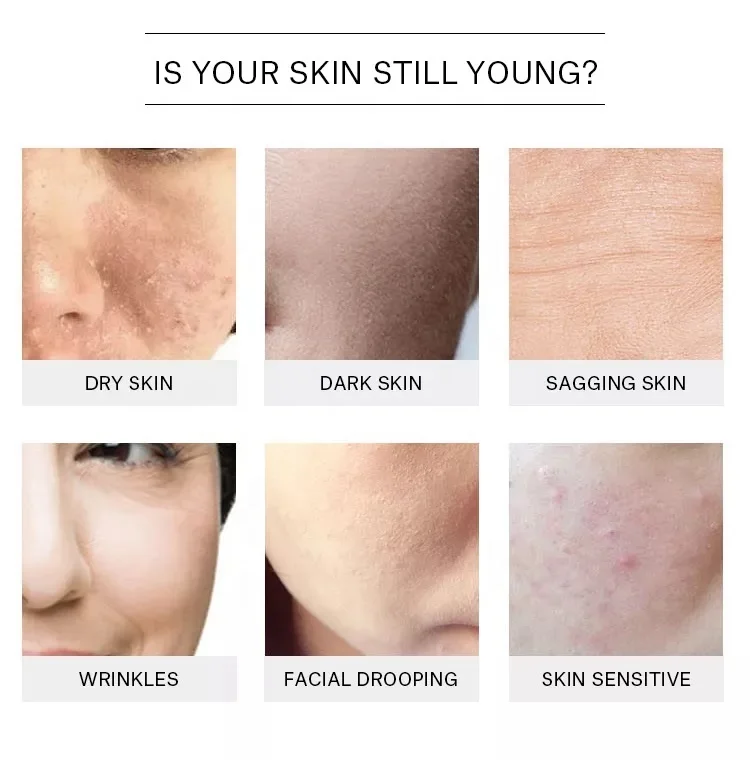 organic soothing face moisturizer spray 100% pure rose floral water toner rose water for skin