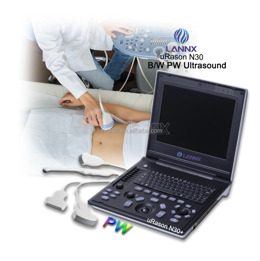 LANNX uRason N30+ Custom Woman Pregnancy ultrasonic scanner Echography laptop Digital USG Diagnostic PW BW Ultrasound Machine