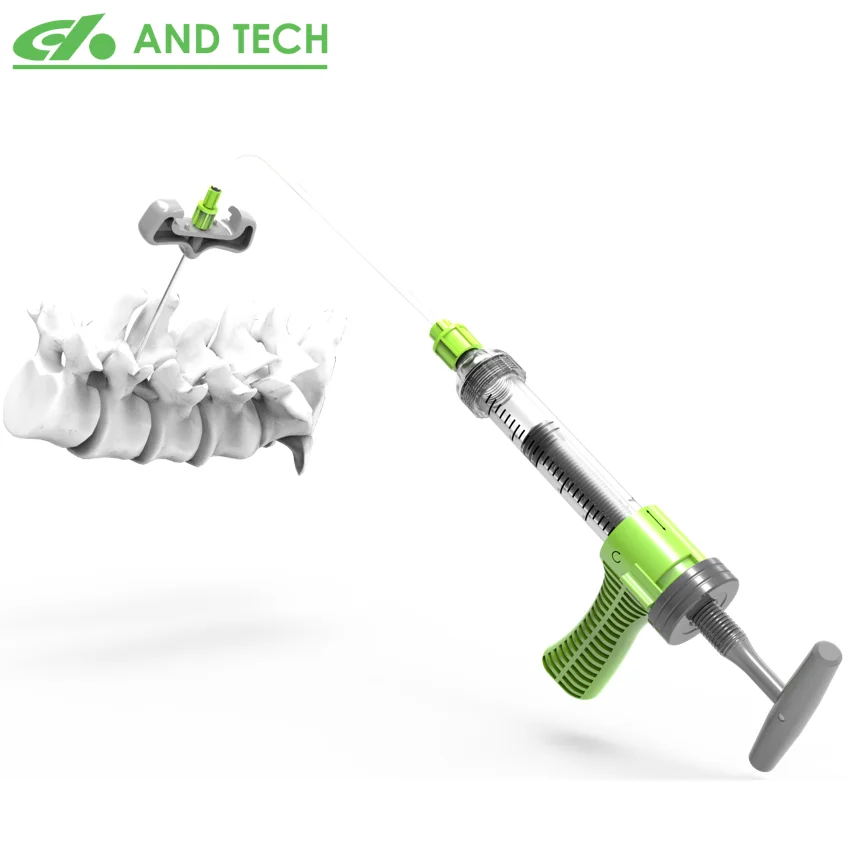 Шприц для костного цемента, инъекционное устройство PKP, инструмент для ортопедической хирургии, для ортопедической и хирургической пластики