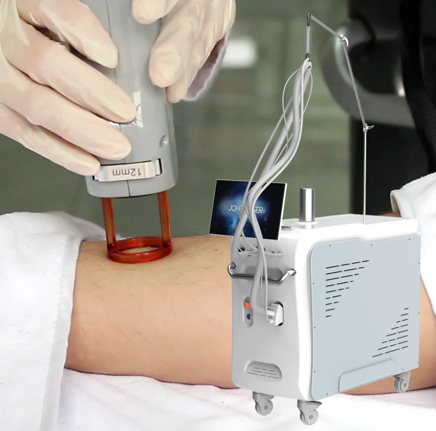 long pulse nd yag laser q-switched active  nd yag laser prices tattoo removal machine