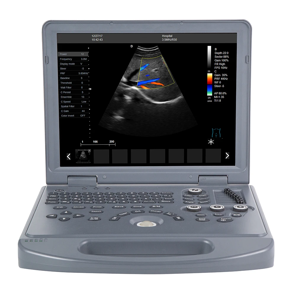 carejoy Portable Laptop 15 inch LED Screen Color Doppler Ultrasound Scanner Echo Scanner Ultrasound Machine