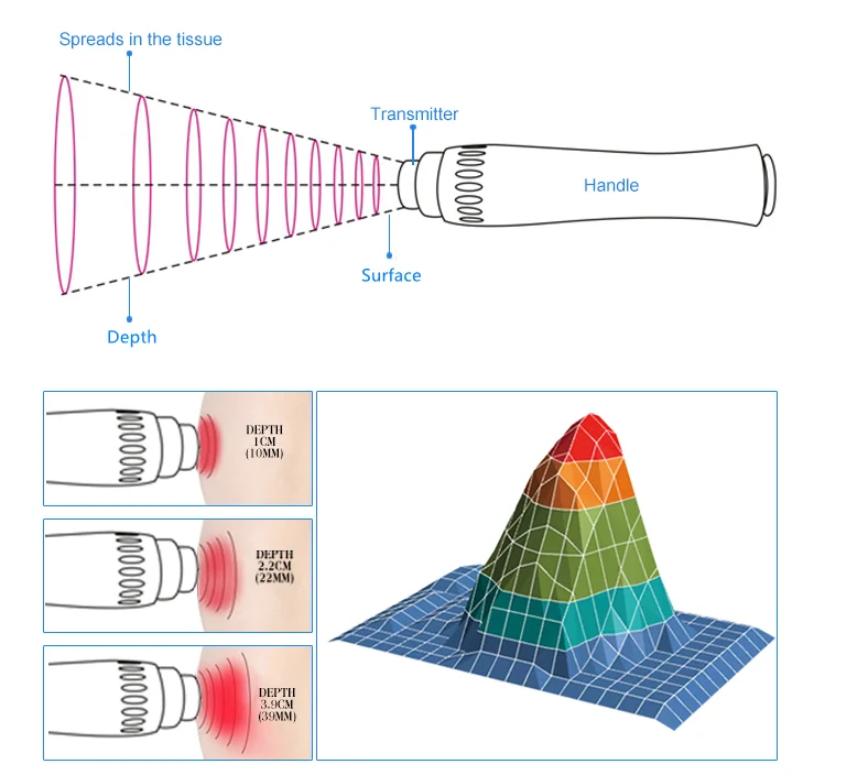 High Intensity Body Pain Relief Device ESWT Device Physical Therapy Equipment Shock Wave Machine