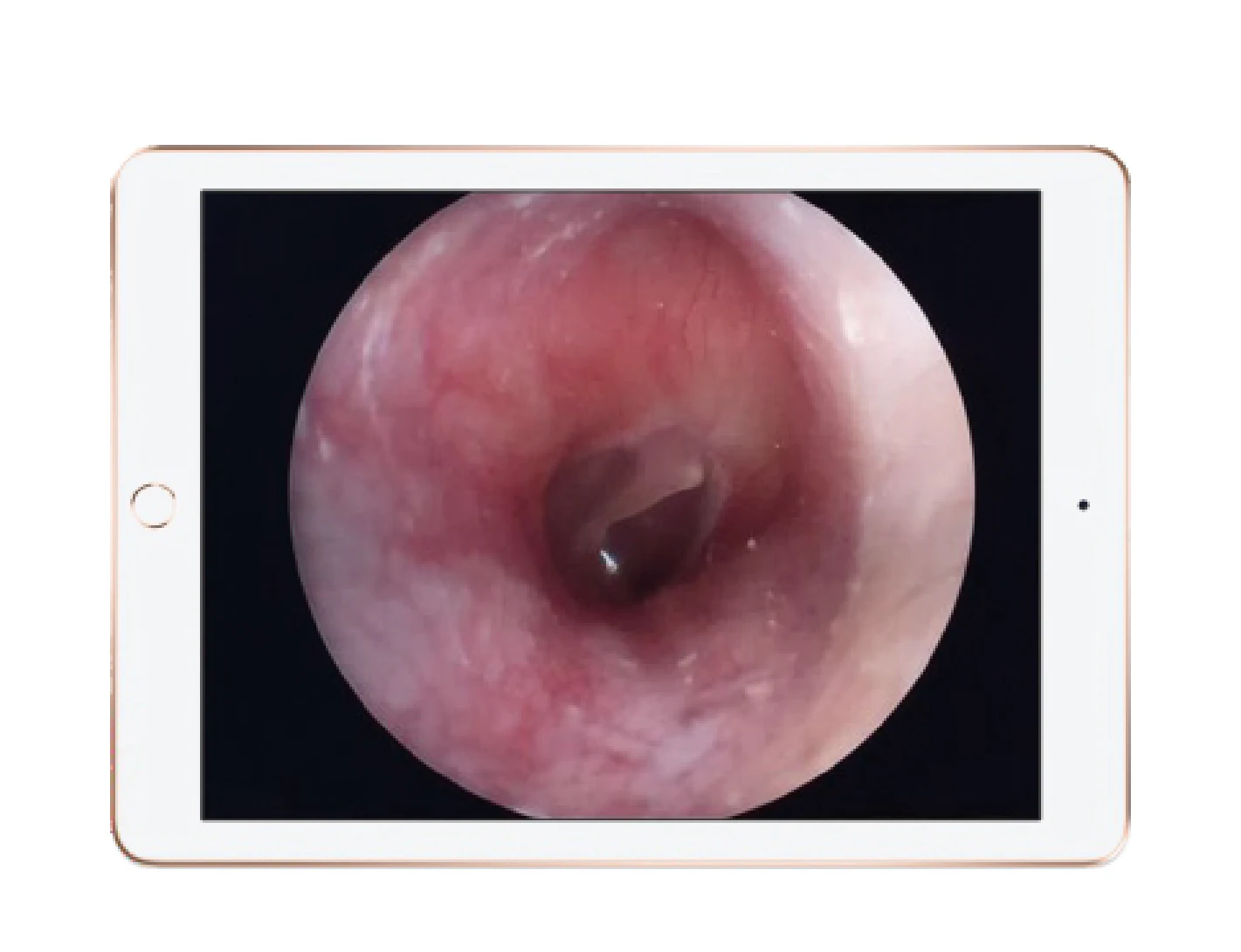 
Portable Wifi Wireless Hd Endoscope Camera System For Ent Departments Ent Endoscope 