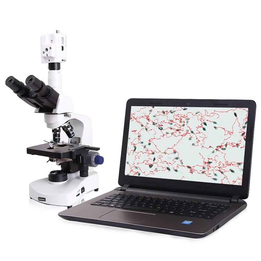 Veterinary Portable Vet Semen Quality CASA Analyzer Automatic Sperm Microscope Analysis Testing Minitube Machine