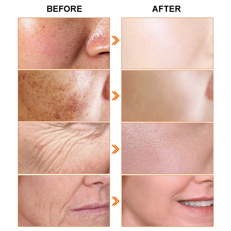 Wholesale Private Label Retinol vitamin c skin care Serum For Hydrating Wrinkles day and night whitening serum skin care set