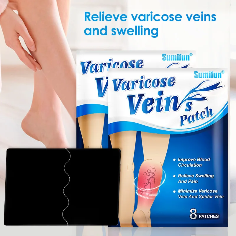 Sumifun 8pcs/bag Chinese Varicose Veins Plaster Vasculitis Phlebitis Spider Leg Medical Patch Angiitis Removal Patch