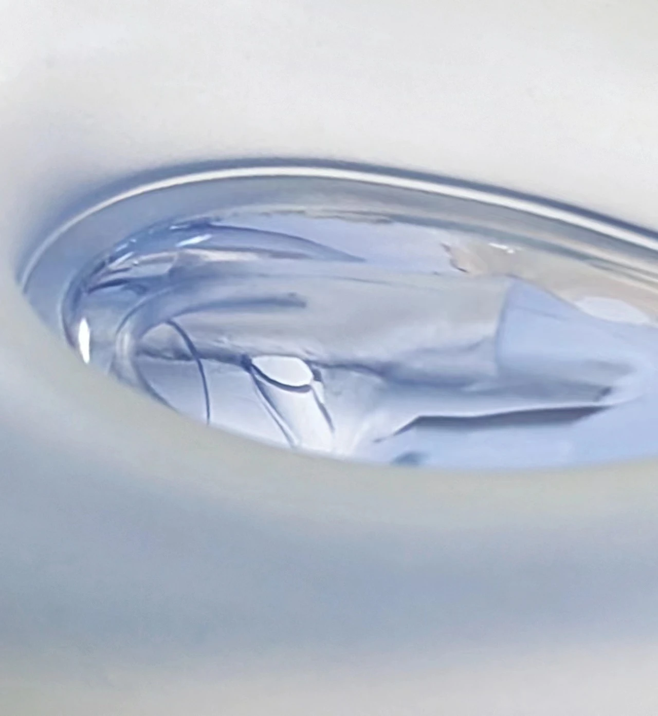Transparent Clear Medical Grade Silicone advanced Laryngeal Mask Airway double Lumen Airway
