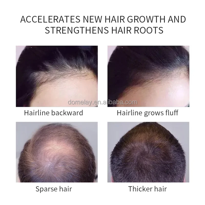 Wholesale Herbal hair Oil Private Label Serum Hair Growth Oil Essential