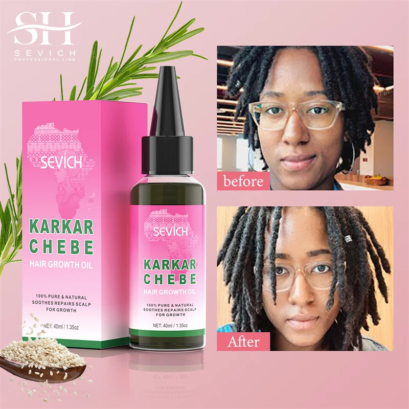 Best Hair Growth Rosemary Oil Veganic Natural Thickening Repairing Nourishing Chebe Oil for Hair Product