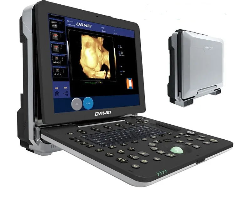 Laptop Type Doppler Medical Ultrasound Equipment High End Model Portable 4D Color Doppler Ultrasound Machine