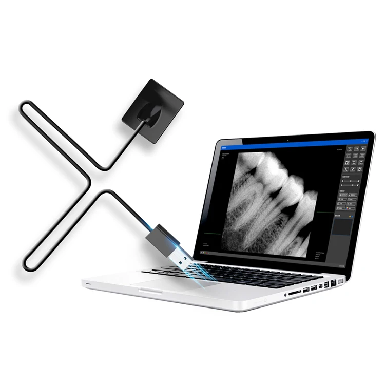 Dental Intraoral X-Ray Imaging System High Definition Intra Oral Digital Sensor Wireless Dental Xray Sensor With Good Price