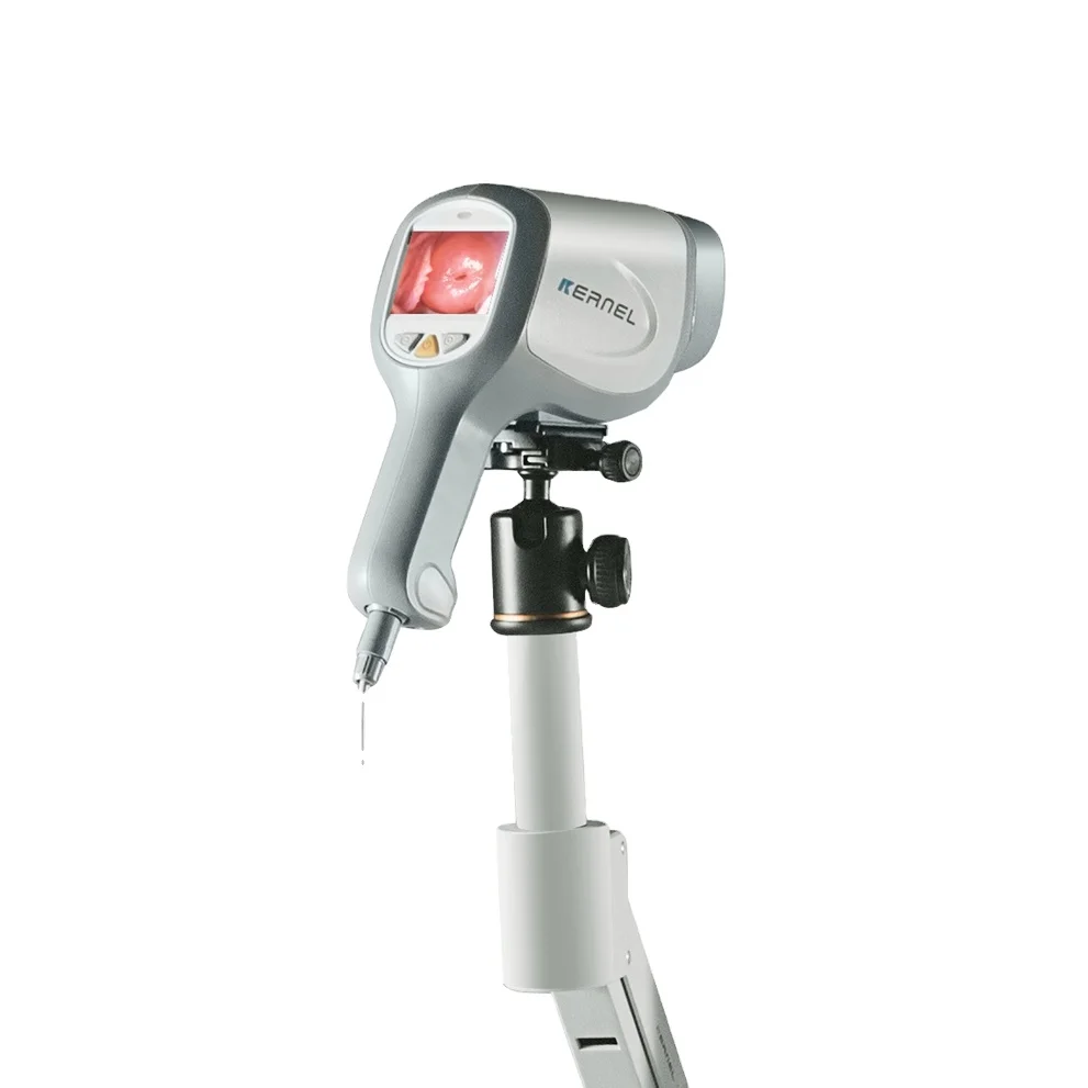 Medical CE Handheld Colposcope Portable Gynecology Colposcopy System Digital Electronic Gynecology Video Colposcope