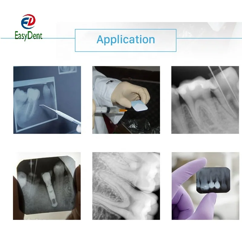 Высококлассный стоматологический рентгеновский пленочный процессор камера разработчика портативная ручная мойка коробка для комнат в продаже