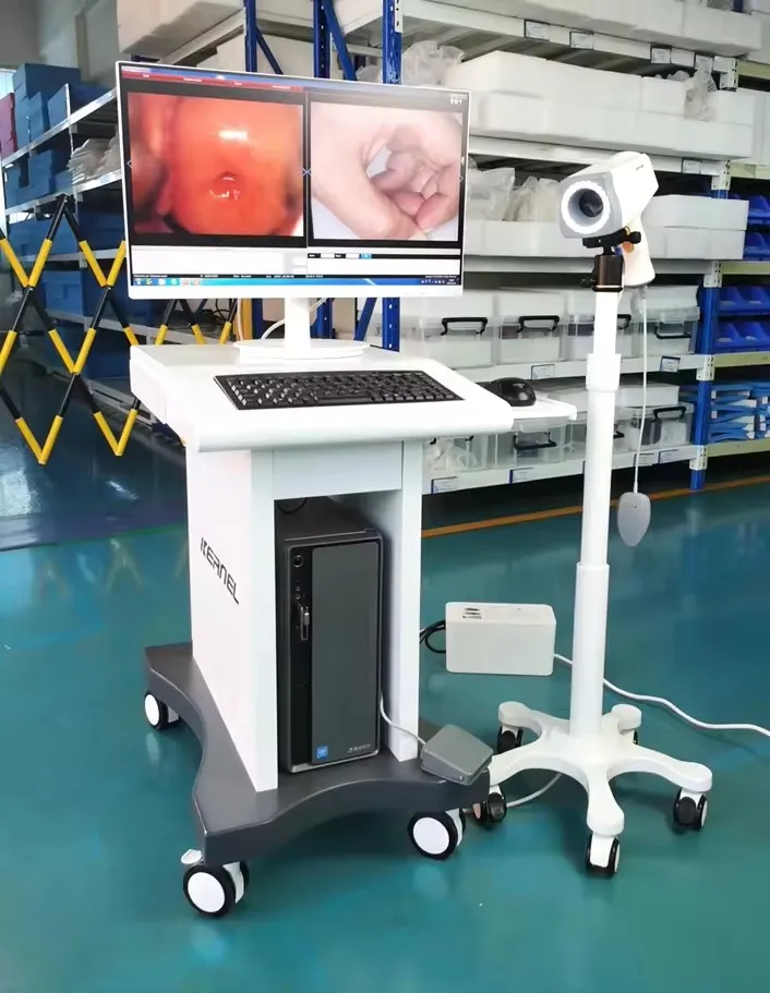 Kernel KN-2200 HD Video Colposcope digital colposcope for gynecology endoscope for cervical cancer and cervical screening