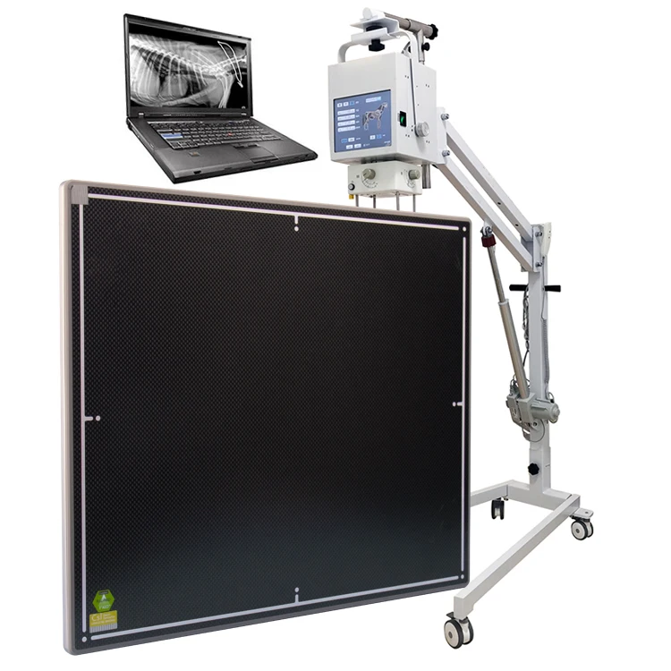 Medical 50Kw LCD Display Portable X Ray Machine Digital X-Ray System Rayos X Portable