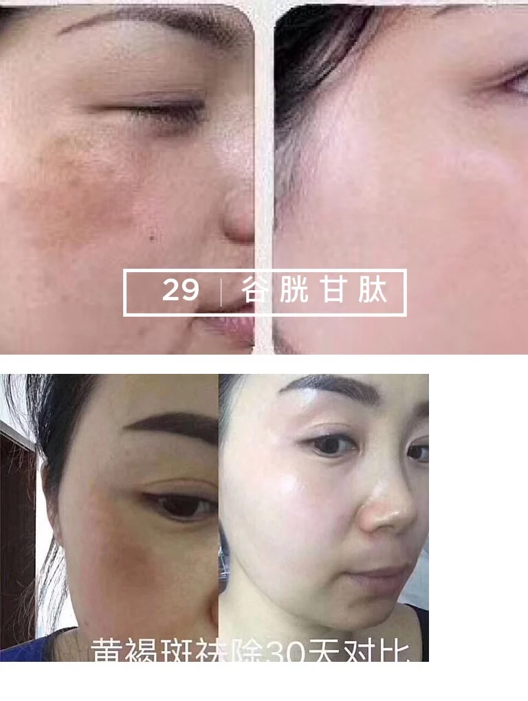 Cosmetics Whitening Moisturizing Lift Firming Whitening Essence Nourishing Soft Skin Care Essence Set