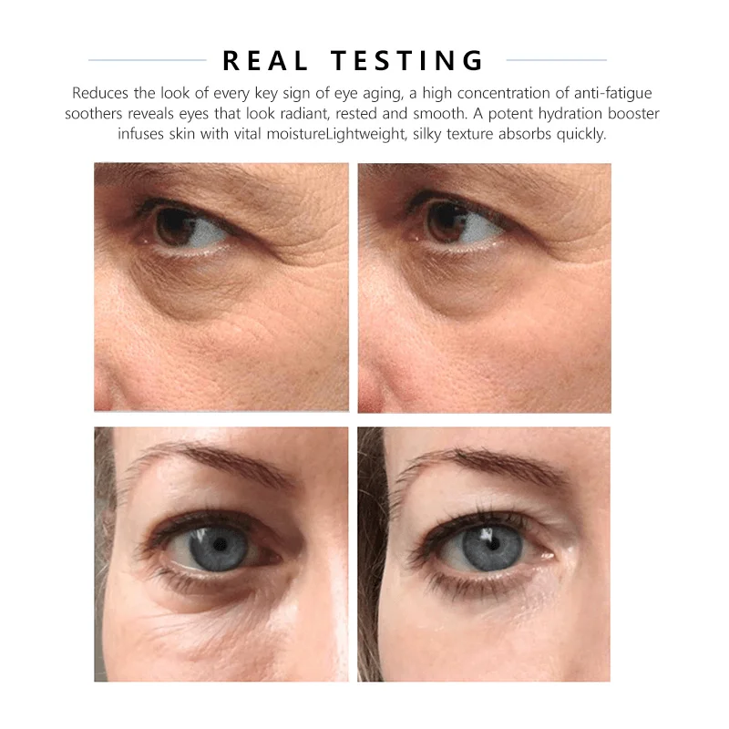 melt removal lifting shadow korean massage eye wrinkle dark anti collagen care eye cream