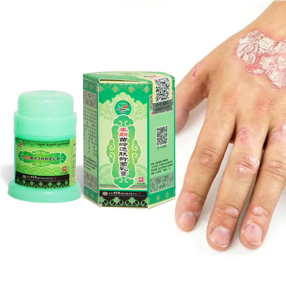 Wholesale Chinese Herbal Acne Antibacterial Ointment Manufacturers OEM Supply Daily Use for Body Skincare for Adults