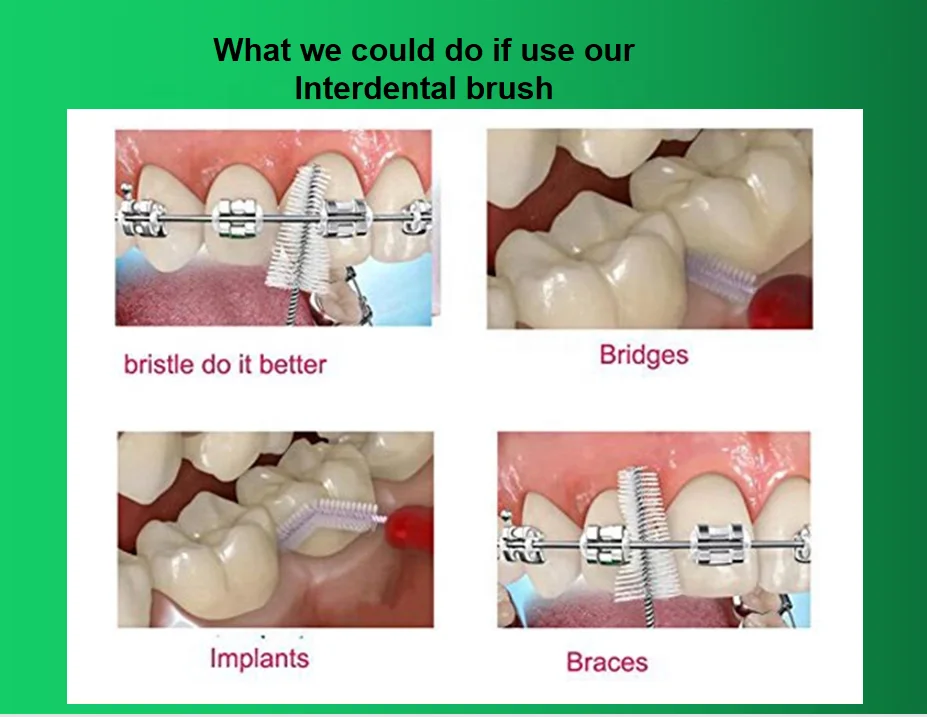 factory selling with own patent  TPE handle food grade OEM  soft handle Interdental Brush teeth health cleaning care