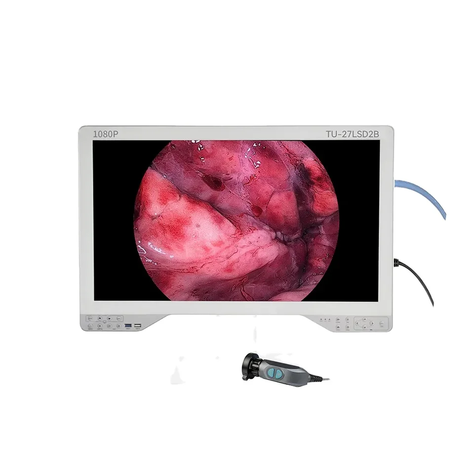 HD Video Endoscope Imaging System with 27-Inch Screen and LED Light Source Integrated Endoscope for Rigid & Flexible lens
