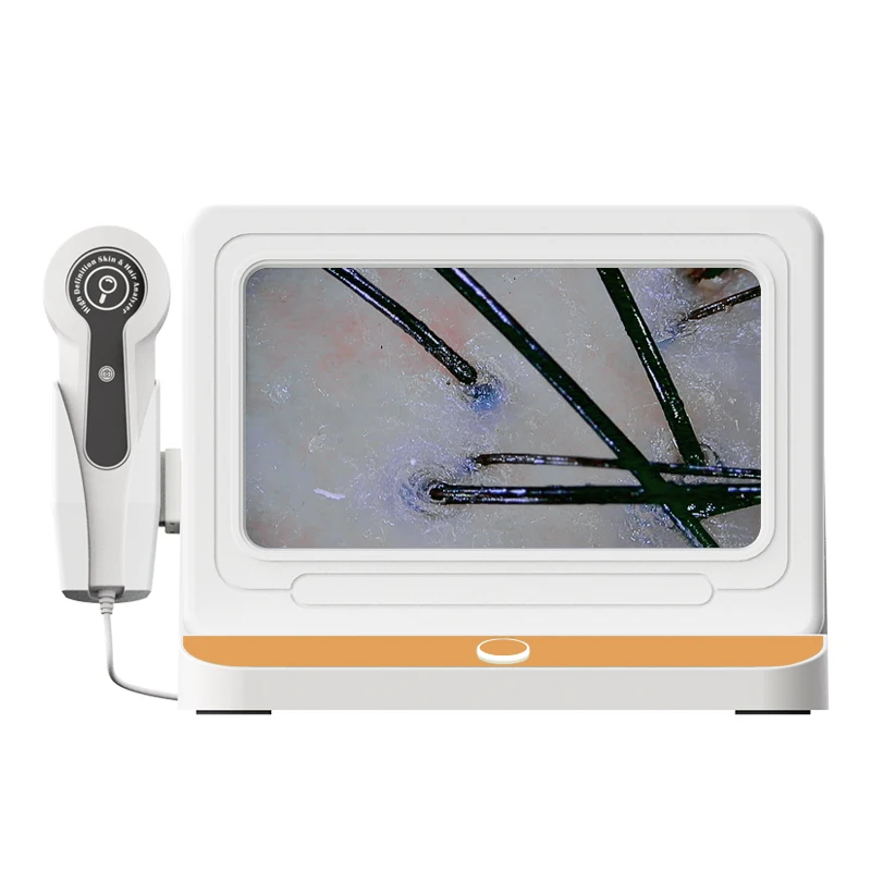 Portable HD Scalp Hair Follicles Scanner Detector Hair Analyzer Skin And Scalp Hair Analysis Machine