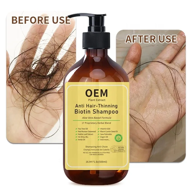 Reduce Hair Loss Product Private Label Guangzhou Factory Manufacturer Wholesale Organic Herbal Hair Care Anti Hair Loss Shampoo