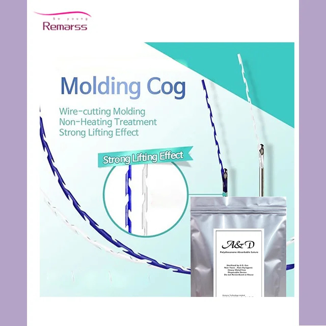 fishbone molding cog