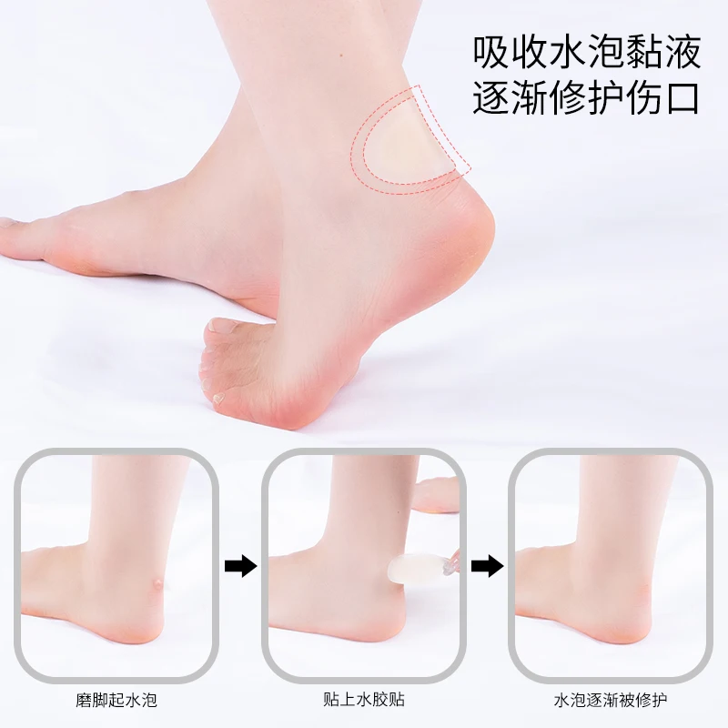 {Hot sale Style} gel blister bandage foot blister pad waterproof colloid is suitable for prevention and recovery of blister on f
