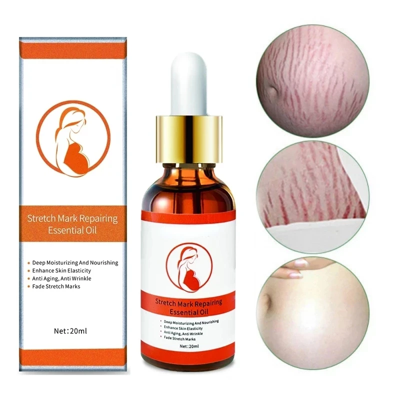 Stretch Marks Remover Essenti al Oil Skin Care Stretch Mark Cream For Stretch Mark Removal Maternity Slackline For Pregnant Oils