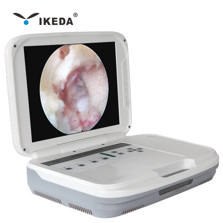 Medical Rigid ENT Portable Endoscope Camera