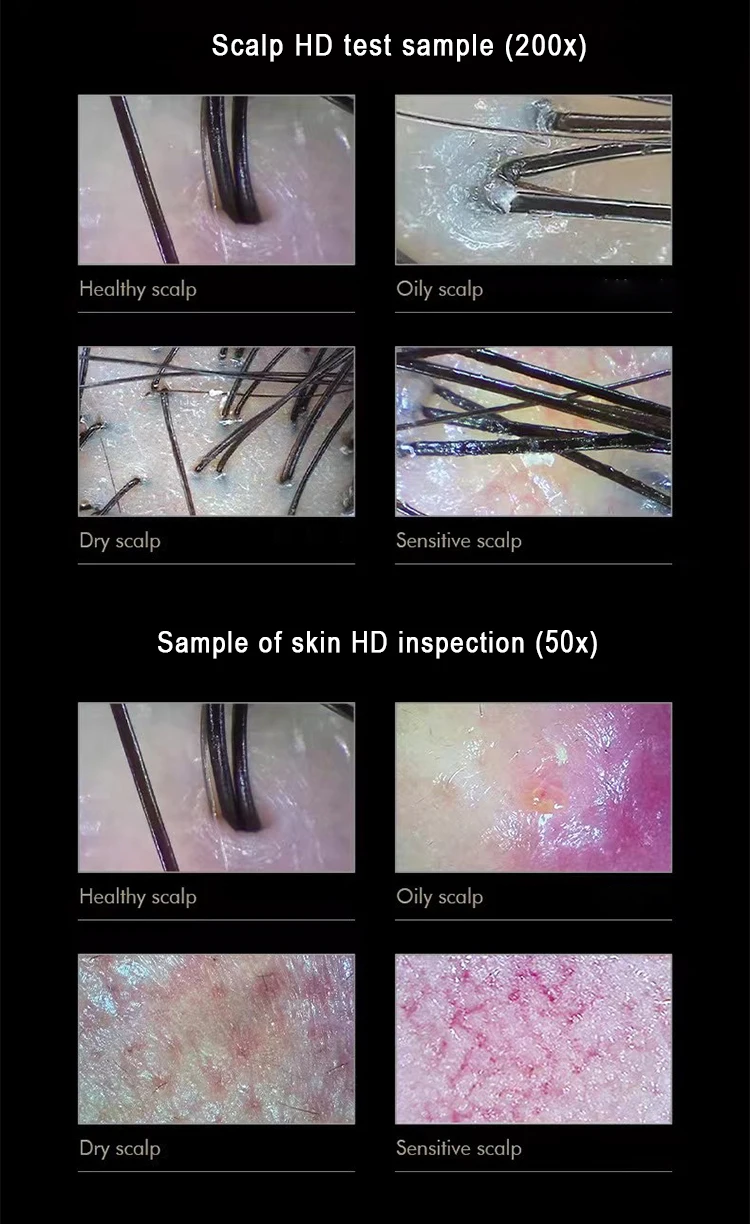 Analyzer Scalp Camera For Hair Mineral Analysis Machine Hair And Skin Analyser For Hair Analysing For Computer Or Mobile